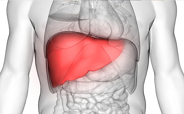 Fatty Liver Disease Guide